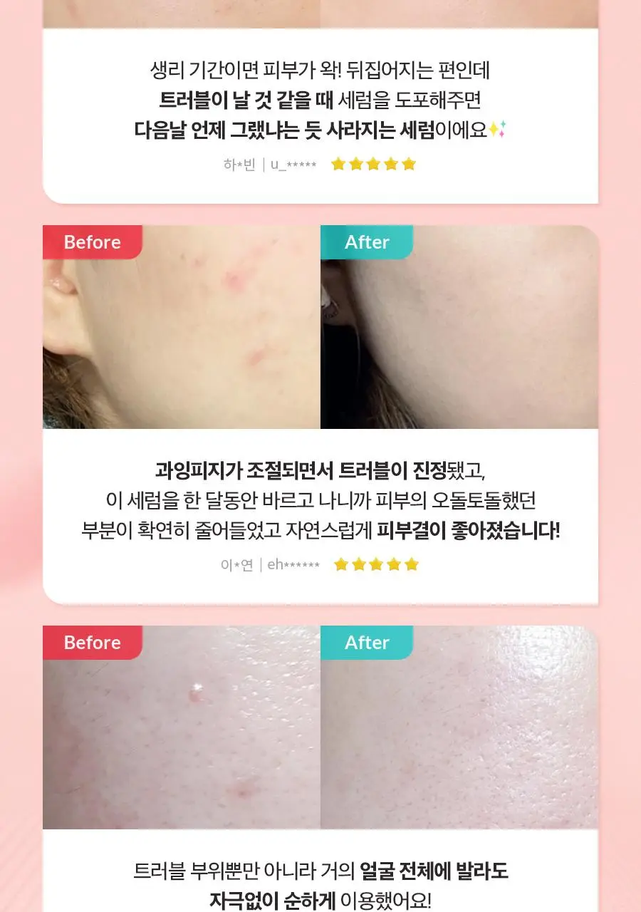 [트러블/대용량] 닥터지 에이클리어 스팟 포 페이스 세럼 80ml 상세페이지 9